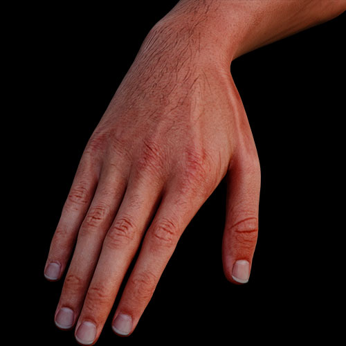 Hand I:\nSurface Anatomy
